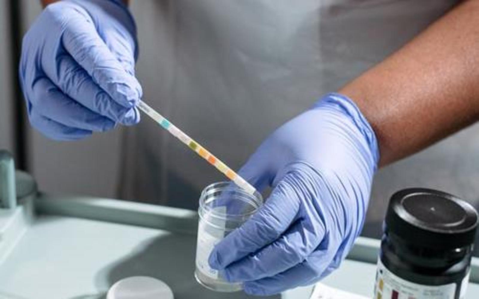Nurse checking pH results against chart