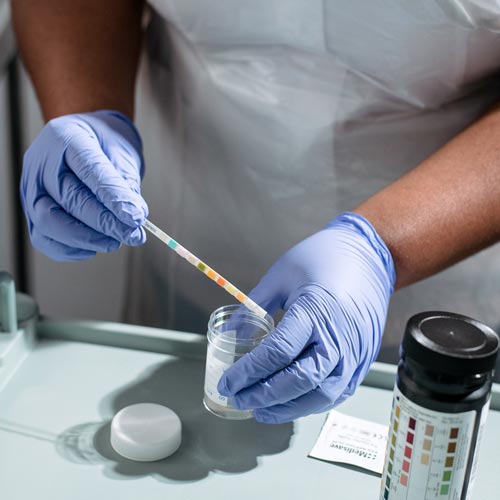 Nurse checking pH results against chart